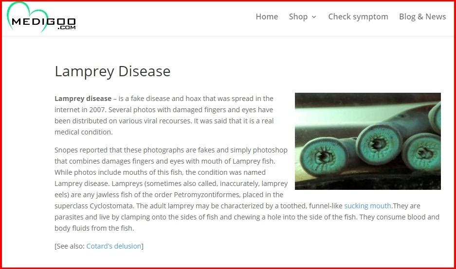 lamprey disease