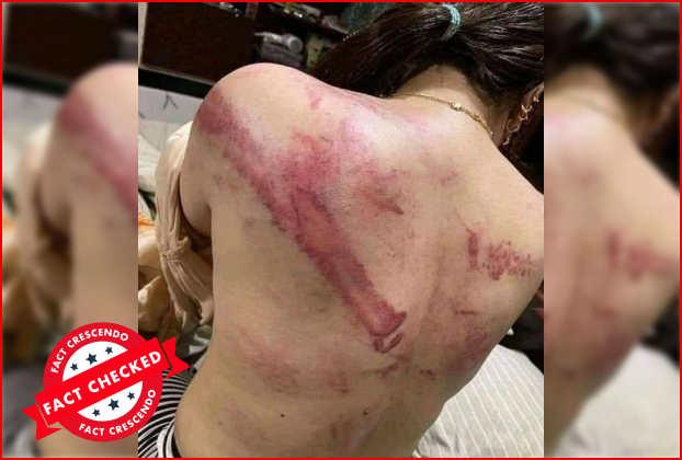 Image from Pakistan shared as woman protestor tortured by Iranian government. – FactCrescendo | The leading fact-checking website in India