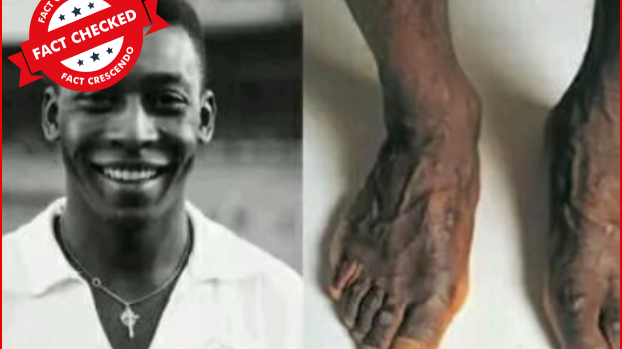 Pele's Feet To Be Kept In Museum? Here's The Truth Behind 'FIFA Decision' -  Newschecker